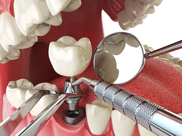 Best Broken Tooth Emergency  in Marion, IA